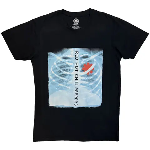X-Ray