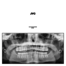 JVC thumbnail