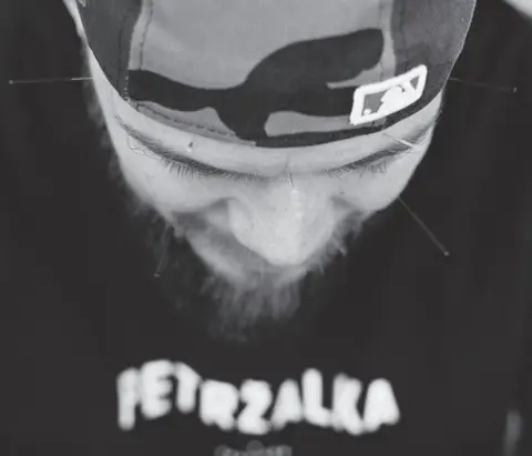 Akupunktúra