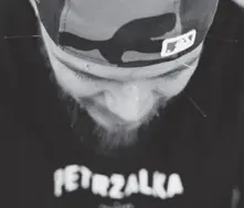 Akupunktúra thumbnail