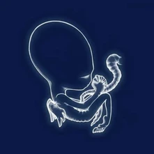 Sigur Rós, Vinyl ÁGATIS BYRJUN