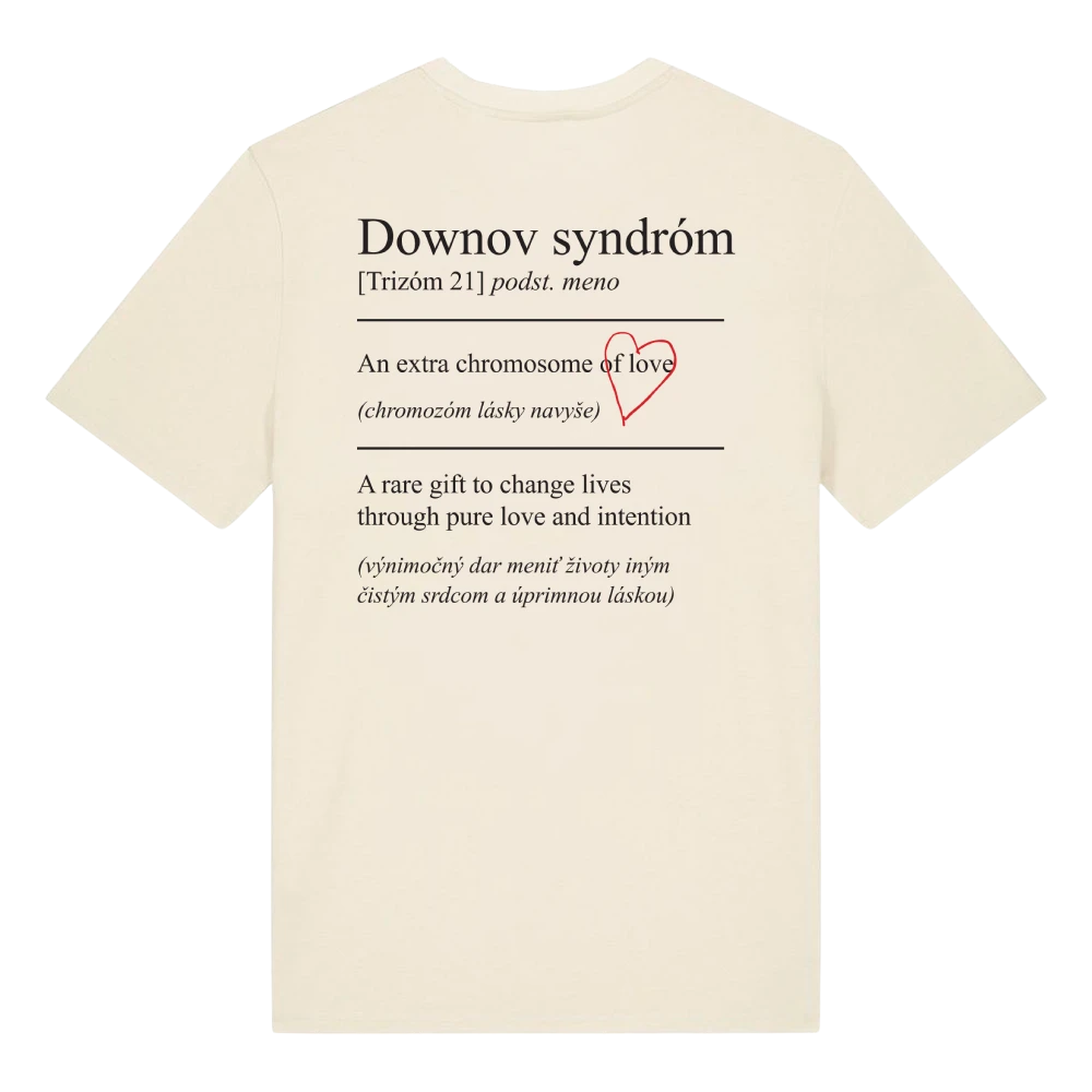 Láska Rozdiely Nevidí Downov syndróm